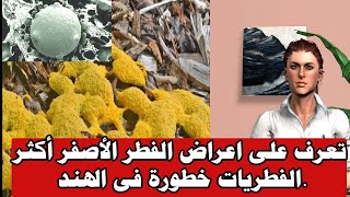 تعرف على اعراض الفطر الأصفر أكثر الفطريات خطورة فى الهند.