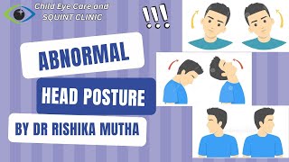 Squint specialist in indore | Abnormal head posture