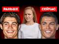Секрет Молодости Рональдо. Разбор всех операций