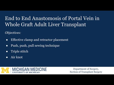 Liver Transplant Portal Vein Anastomosis