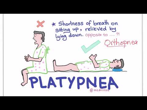 Platypnea-Orthodeoxia Syndrome