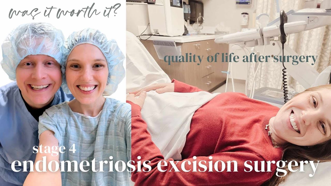 Операция по поводу эндометриоза 4 стадии: стоило ли оно того? Мой честный опыт.