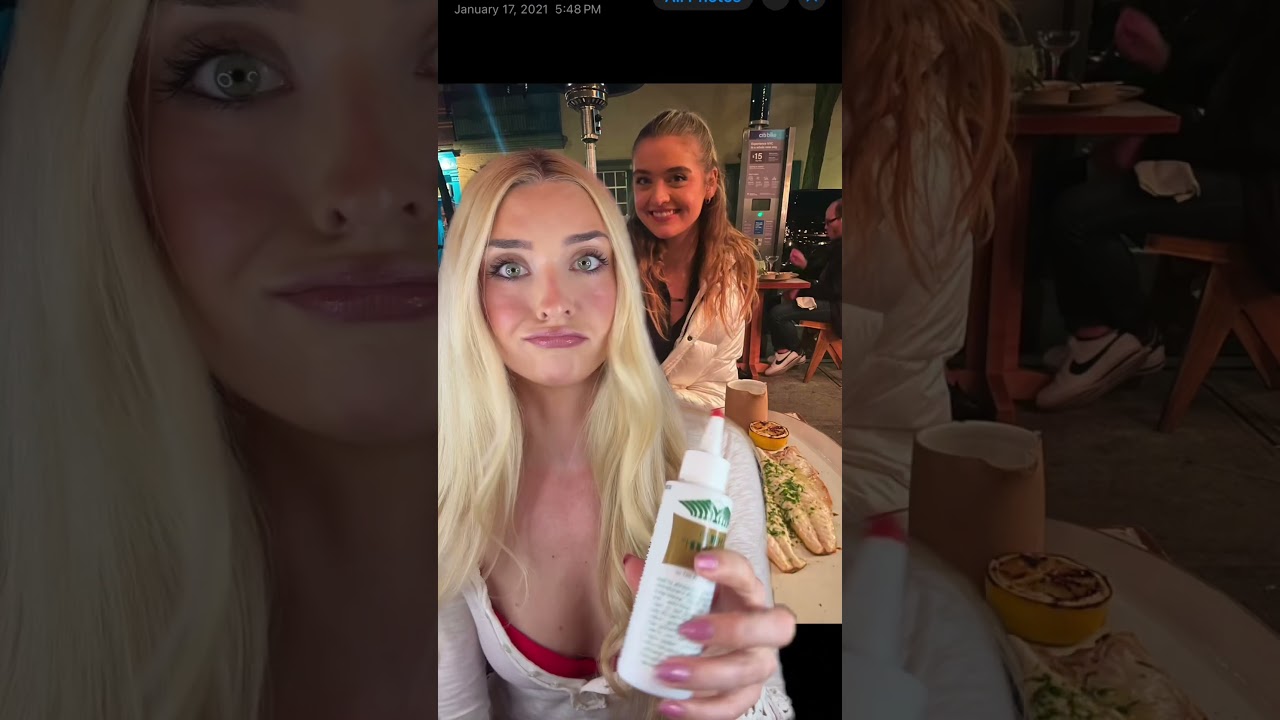 BAYLEE: how i fixed my bald spot