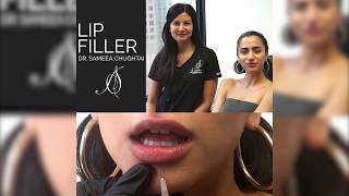 Lip Fillers with Dr. Sameea Chughtai