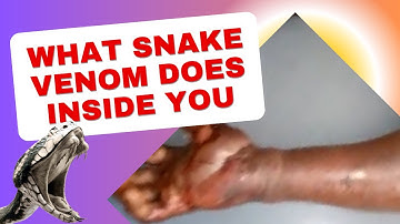 This is What REALLY Happens to Your Body When a Venomous Snake Bites You