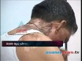 Acid Attack Trivandrum Internatinal Airport