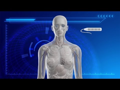 New implant allows ALS patient to communicate using brain activity