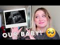 30 week fetal echo & ultrasound!