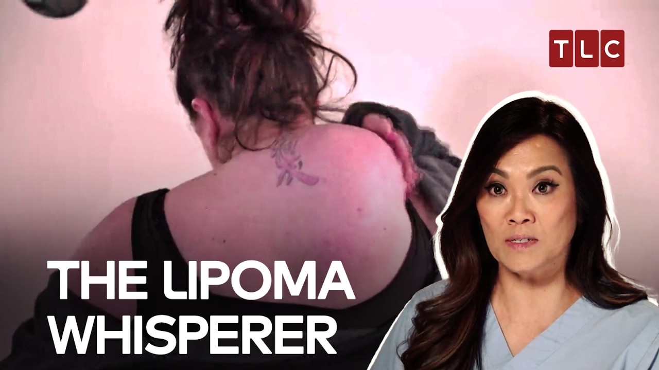 Will Melissa Get A Cure For Her Lipoma? | Dr Pimple Popper S1 E2 | TLC