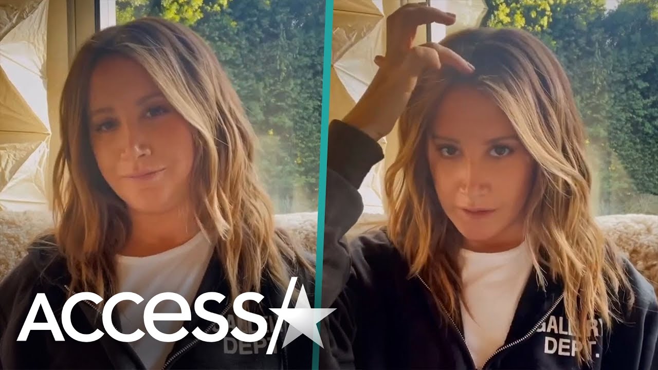 Ashley Tisdale Struggling w/ Hair Loss Due To Alopecia