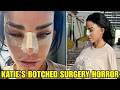 Katie Price’s Botched Surgery Nightmare Just Took A Dark Turn