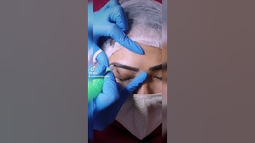 Here we are fixing her old MiCROBLADING and formed a new shape by micro shading,