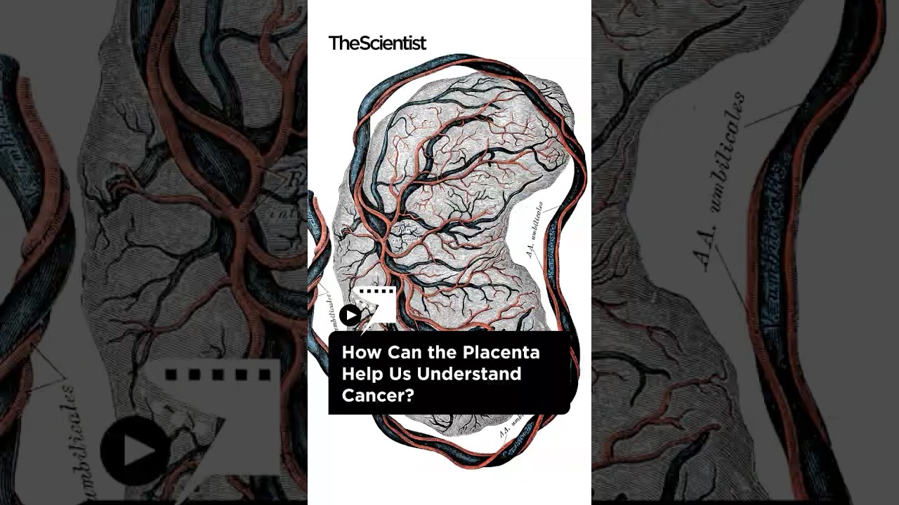 How Can the Placenta Help Us Understand Cancer? | The Scientist