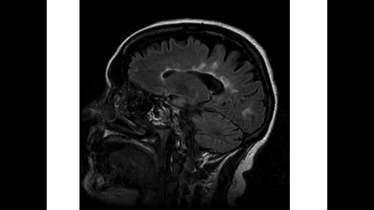 ch5-research-methods-of-biopsychology-youtube
