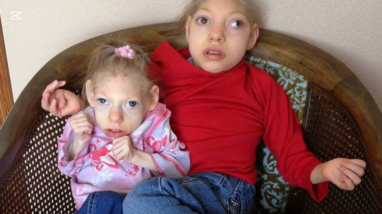 Microcephaly in Pakistan | Causes, Genetics & Prevention