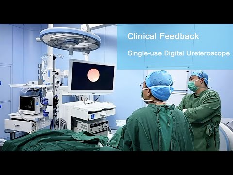 Clinical feedback – Geyi Single-use Digital Ureteroscope
