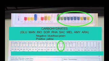 Microbiology: Using API Strips 3
