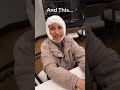 Dr Karam S Wife S FACELIFT TRANSFORMATION Progression Dr Karam S Wife S FACELIFT TRANSFORMATION Progression