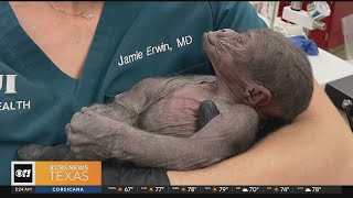 North Texas OB-GYN helps the Fort Worth Zoo with a unique situation