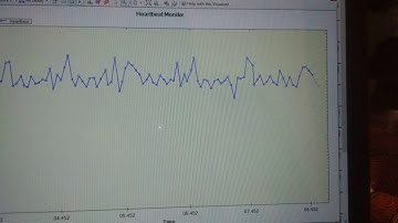 Final: Heart Rate Monitor with the AD8232