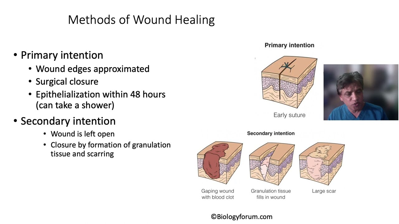 Fundamental Concepts In Wound Healing YouTube