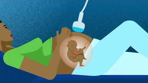 What is a Fetal Echocardiogram? | Children