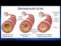 2.16. Массаж при бронхиальной астме, эмфиземе легких | Медицинский массаж. Цикл 2