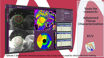 Medis Suite MR - All in One 2020