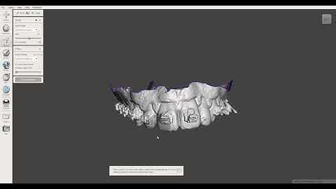How to remove brackets virtually in meshmixer