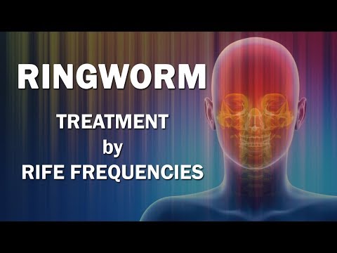 Video: Ringworm: Simptomi, Slike, Zdravljenje, Diagnoza In Drugo