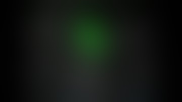 Robotic Right Lower Lobe Superior Segmentectomy - ICG Marking of Tumor