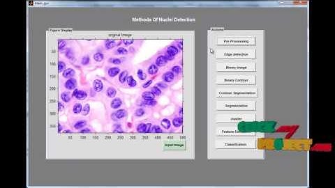 Final Year Projects 2015 |  Methods for Nuclei Detection, Segmentation, and Classification