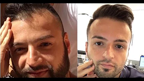 Kdo je nejlepším přípravkem na vypadávání vlasů?