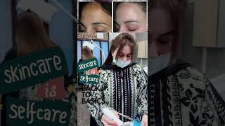 Pigmentation treatment #theskinhub1 #shortsviral #youtube #youtubeshorts #pigmentationremoval