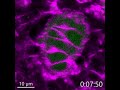 生殖細胞で活発化する細胞膜ブレビング