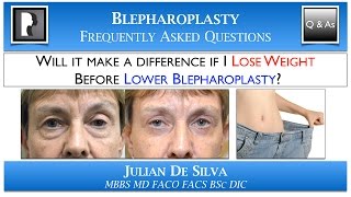 Will LOSING WEIGHT make a difference before Lower Blepharoplasty?