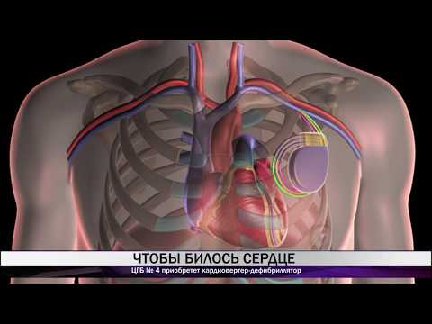ЦГБ № 4 приобретет кардиовертер-дефибриллятор