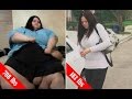 Christina Phillips shows who lost 525LBS after surgery