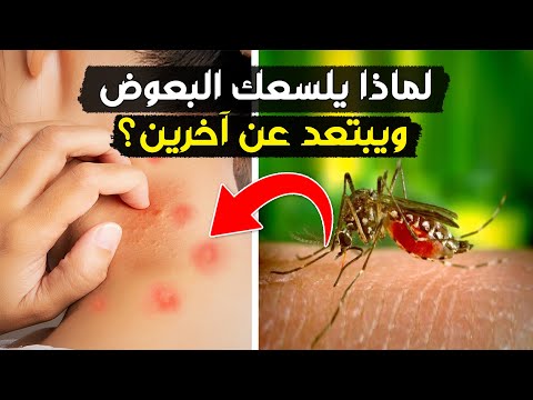 لماذا يلسع البعوض بعض الناس بلا هوادة ويتجاهل البعض الآخر