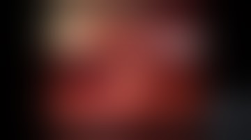 Robotic Resection of Gastric GIST