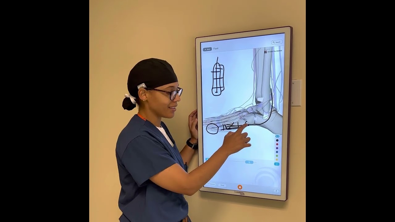 5th Metatarsal Fractures