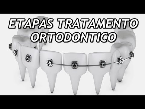 Vídeo: Como passar fio dental: 14 etapas (com fotos)