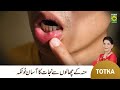Zubaida apa totkay  muh k chalon ka ilaj  mouth ulcers causes  treatment  masalatv
