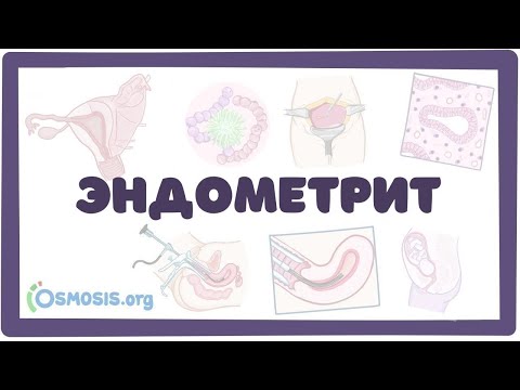 Эндометрит - симптомы, причины, лечение (гинекология) лекция