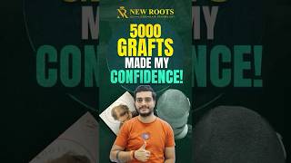 Download Lagu Natural Hairline \u0026 Full Density Achieved! | Hair Transplant in Nagpur #naturalhairline #shorts MP3 Download Lagu Natural Hairline \u0026 Full Density Achieved! | Hair Transplant in Nagpur #naturalhairline #shorts MP3