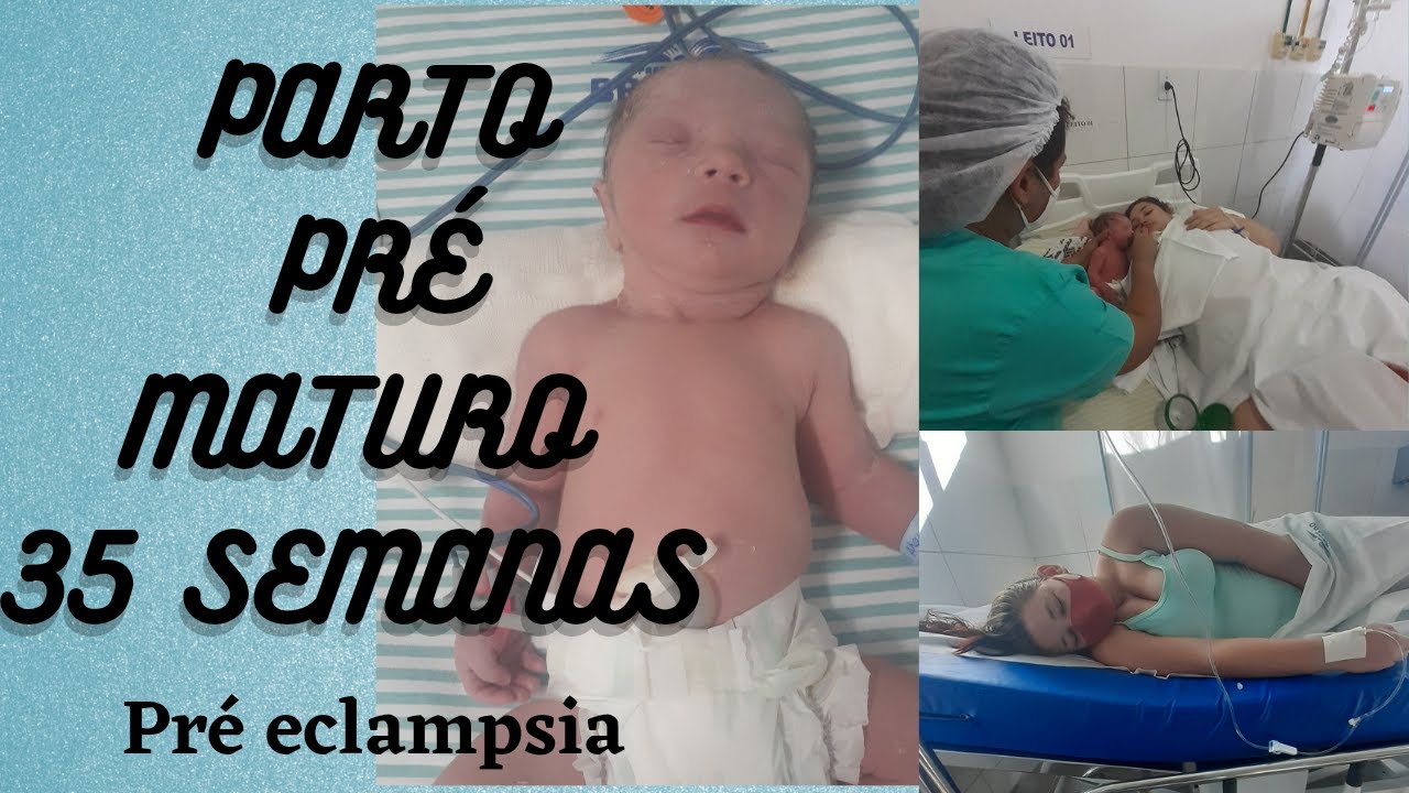 Relato de Parto | 35 semanas | PRÉ ECLAMPSIA - YouTube
