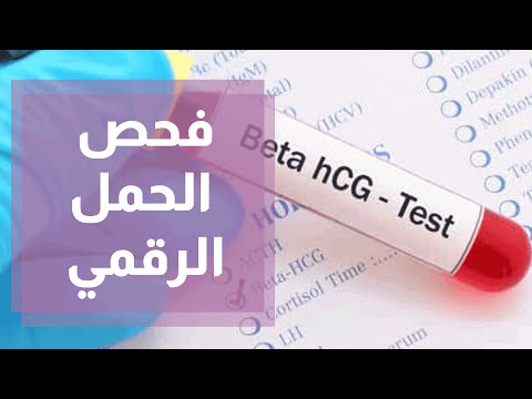 فحص الحمل الرقمي B HCG ودقته