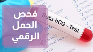 فحص الحمل الرقمي B HCG ودقته