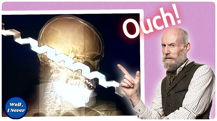 Ron Hunt's Very Bad Day | Well, I Never