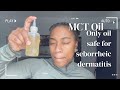 MCT Oil with Seborrheic Dermatitis | Brittany Katherine